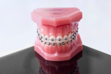 Preguntas sobre ortodoncia