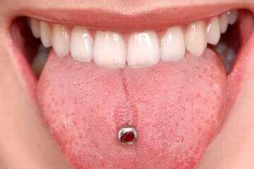 Duelen las perforaciones en la lengua