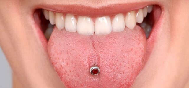 Duelen las perforaciones en la lengua