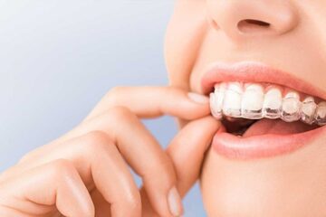 Tratamiento de ortodoncia con Invisalign en Madrid