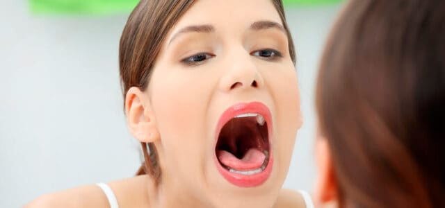 Ver manchas blancas en la lengua