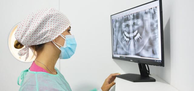 Cirugía en implantología oral