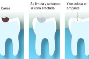 Pasos del empaste dental