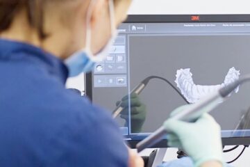Escáner intraoral en 3D de Odontología