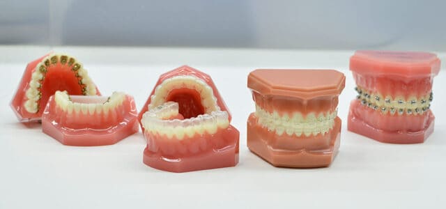 Ortodoncia y carillas dentales