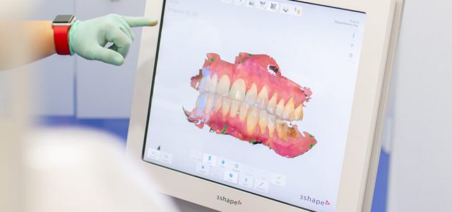 Innovación en Odontología