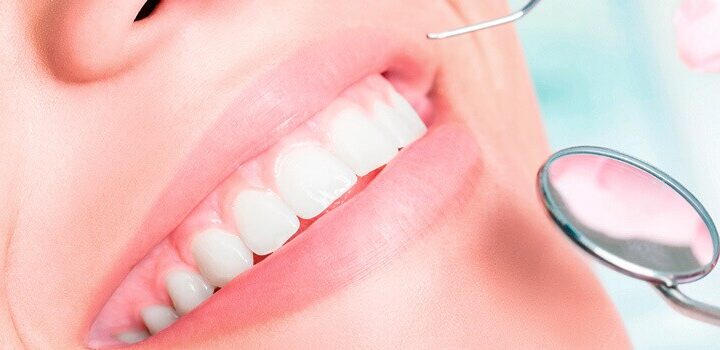 ¿qué Es Un Ultrasónico Dental O Scaler Usos En Odontologíaemk 3453