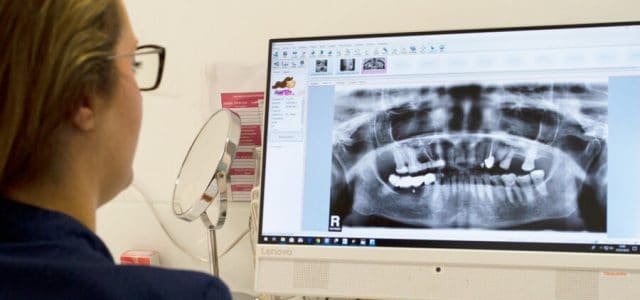 Radiografía de una dentadura