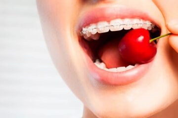 La ortodoncia restringe la dieta