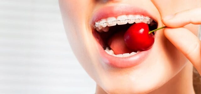 La ortodoncia restringe la dieta