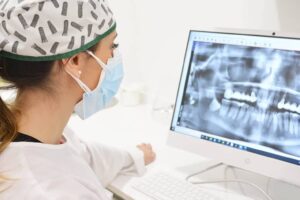 Síntoma del rechazo de un implante dental