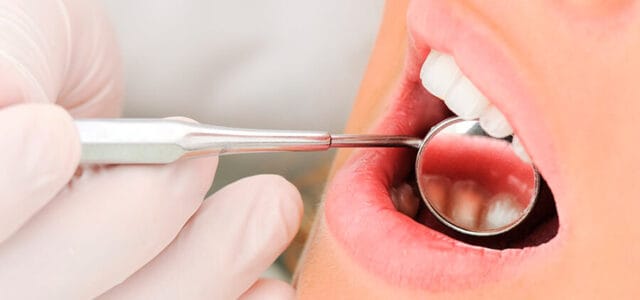 Síndrome de la boca ardiente tratamiento