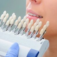 Cómo eliminar las manchas en los dientes