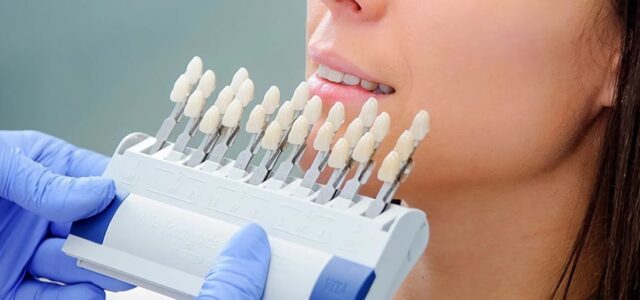 Cómo eliminar las manchas en los dientes
