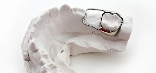 Tratamiento de ortodoncia para la anquilosis dental